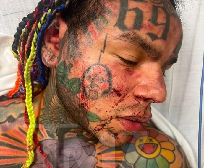 El rapero Tekashi 6ix9ine fue hospitalizado tras recibir una brutal…